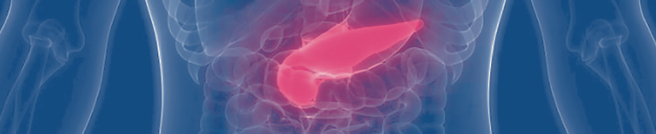 Pancreatitis en niña con tratamiento anticonvulsivante 1 pancreatitis en nina con tratamiento anticonvulsivante 1